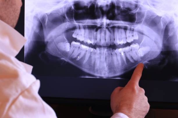 Best Broken Tooth Emergency  in Rhome, TX