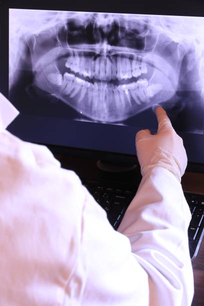 Best Emergency Tooth Extraction  in Rhome, TX