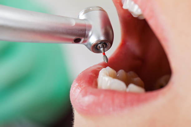 Best Emergency Dentist Near Me  in Rhome, TX